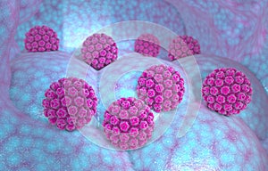 Human papillomavirus infection. Virus. HPV is the most common sexually transmitted infection globally. photo