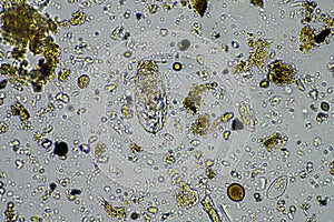 human parasites in the human gut