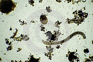 human parasites in the human gut