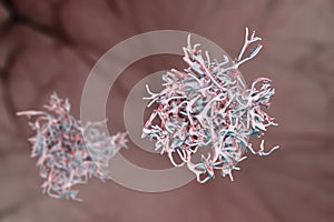 Human parasitic amoeba with pseudopodia