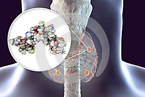 Human parathyroid hormone