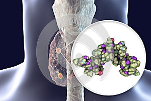 Human parathyroid hormone