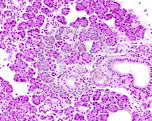 Human parotid gland photo