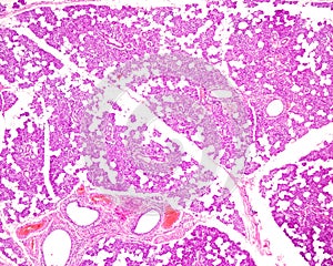 Human parotid gland photo