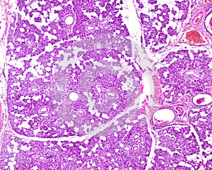 Human parotid gland photo