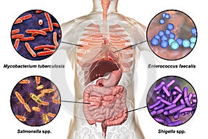 Human pathogenic microbes, respiratory and enteric pathogens photo