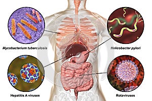 Human pathogenic microbes, respiratory and enteric pathogens