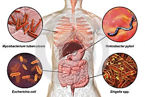Human pathogenic microbes, respiratory and enteric pathogens photo