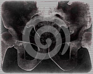 Human Pelvis X-Ray concept