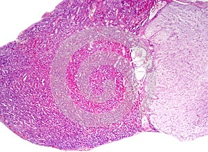 Human pituitary gland