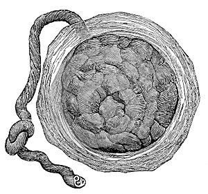 Human placenta from just after birth with the umbilical cord in place.