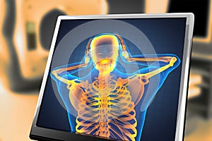 Human radiography scan