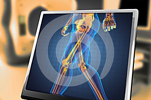 Human radiography scan