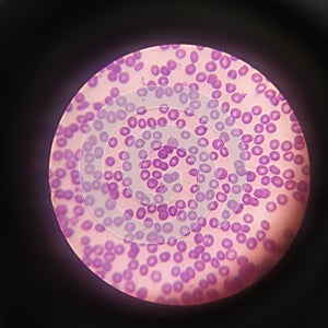 Human red blood cells RBCs photo