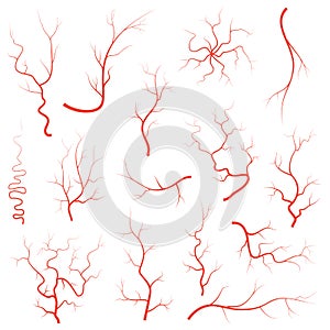 Human red eye veins set, anatomy blood vessel arteries illustration group. Vector medical eyeball vein arteries system