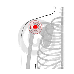 Human shoulder joint pain anatomy.