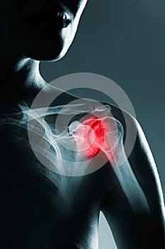 Human shoulder joint in x-ray