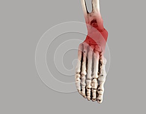 Human skeleton foot with red point at heel and ankle. Injury, plantar fasciitis, tendinitis consequences. Medical photo