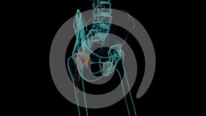 Human skeleton with a metal hip prosthesis 3d render animation X-ray image