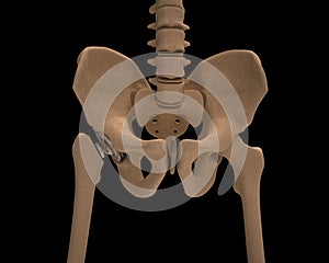 Human skeleton with a metal hip prosthesis concept arthroplasty
