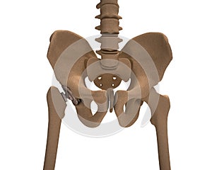 Human skeleton with a metal hip prosthesis concept arthroplasty