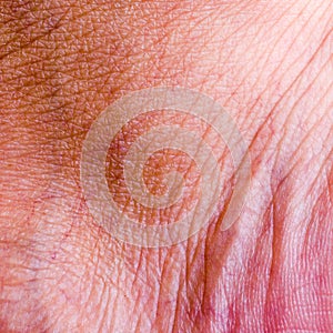 Human skin closeup background.