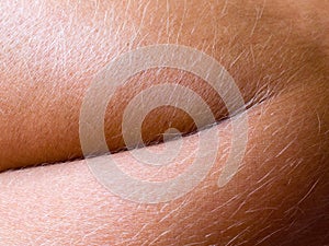 Human skin closeup background.