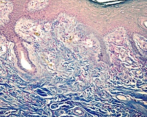 Human skin dermis. Elastic fibers photo