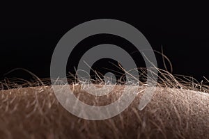 Human skin with hair on black background. Goose bumps