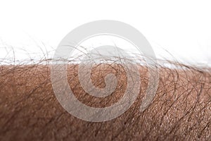 Human skin with hair on white background. Goose bumps