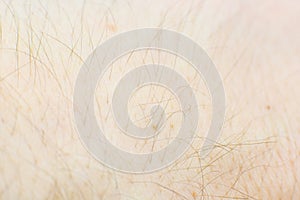 Human skin with hairs texture background. Macro photo, close up