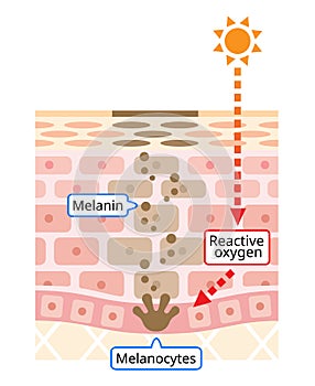 Human skin layer of melanin and facial dark spots. Infographic skin layer illustration. Beauty and skin care concept