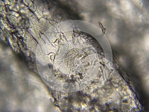 Human skin sample in microscope