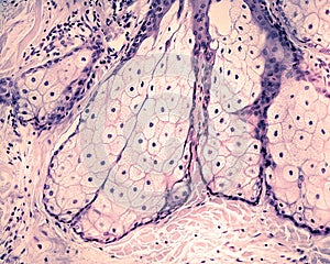 Human skin. Sebaceous gland