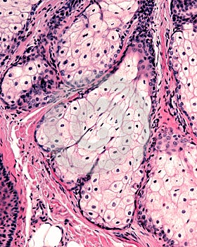 Human skin. Sebaceous gland