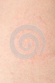 Human skin texture with black hairs on the skin for healthy back