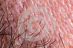 Human skin texture with pores and hair