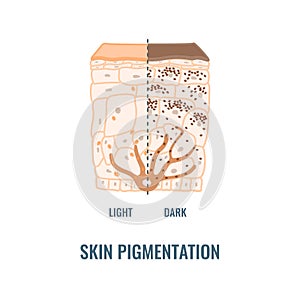 Human skin tone pigmentation diversity infographic diagram