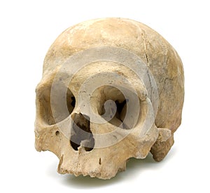 Human skull