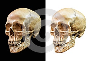 Human skull isolated