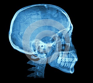 Human skull X-ray image