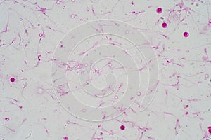 Human sperm morphology under microscope.