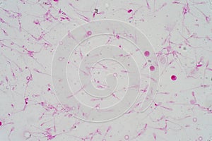 Human sperm morphology under microscope