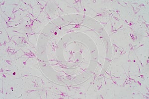 Human sperm morphology under microscope.