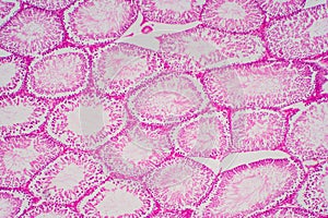 Human sperm in the testis morphology under microscope