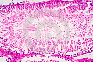 Human sperm in the testis morphology under microscope photo