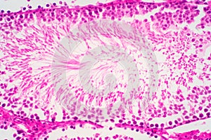 Human sperm in the testis morphology under microscope