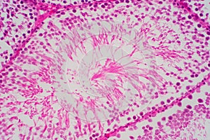 Human sperm in the testis morphology under microscope