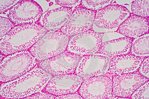 Human sperm in the testis morphology under microscope