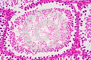 Human sperm in the testis morphology under microscope photo